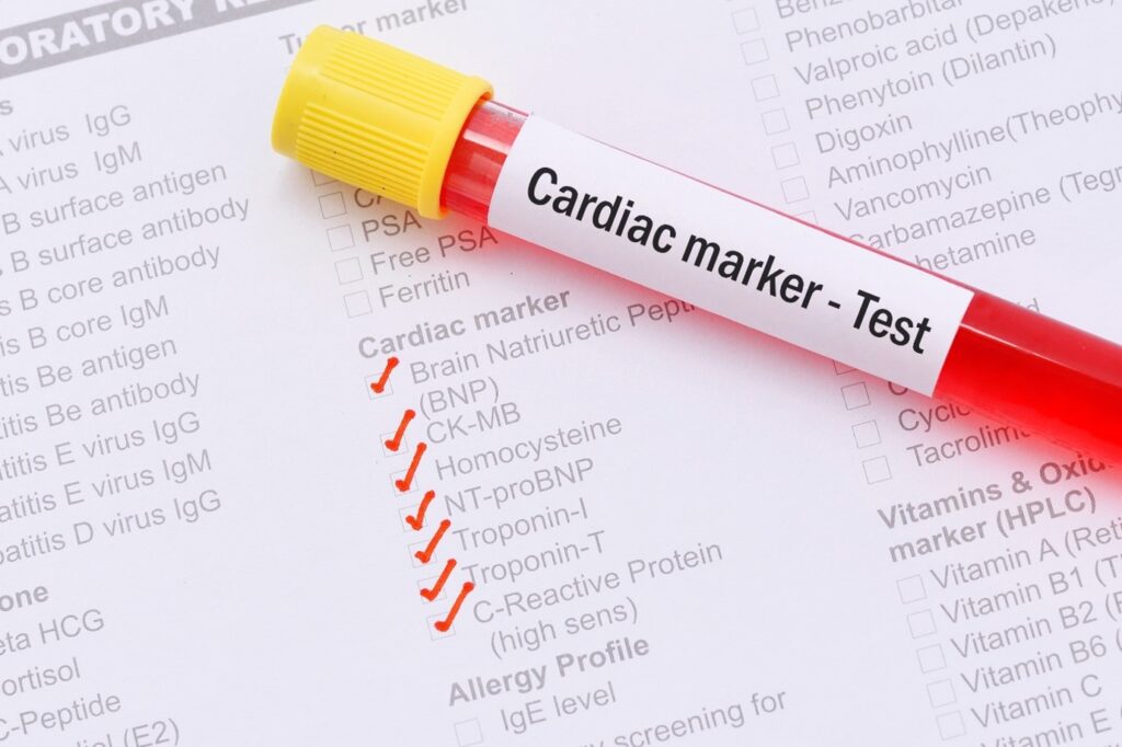 Cardiac Health Unveiled: Essential Tests for a Strong Heart